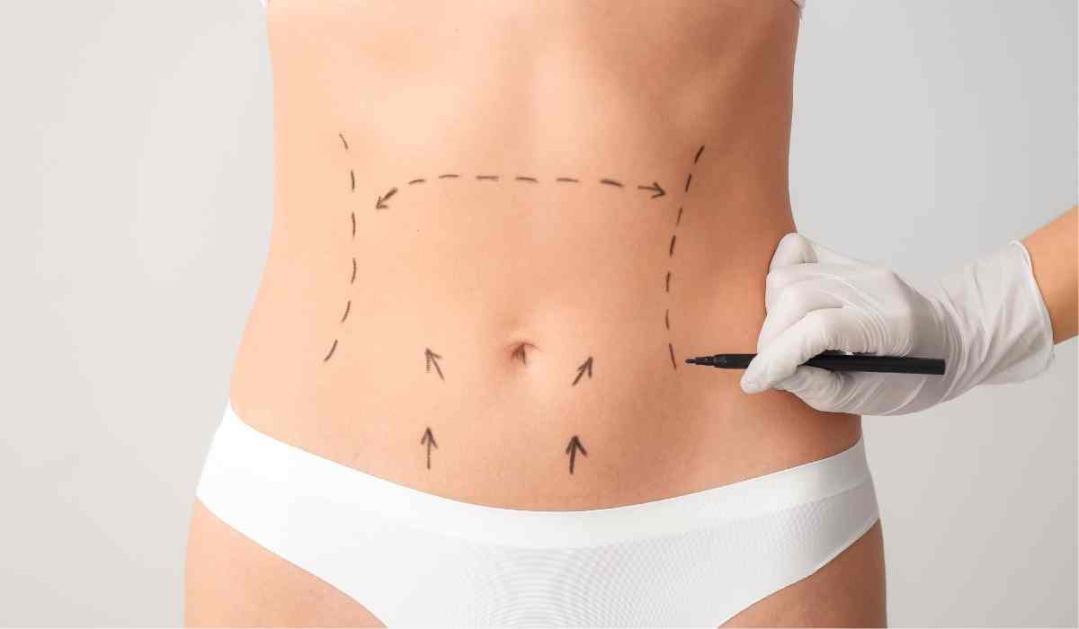 أشهر-عمليات-التجميل-في-مصر (2) أشهر-عمليات-التجميل-في-مصر