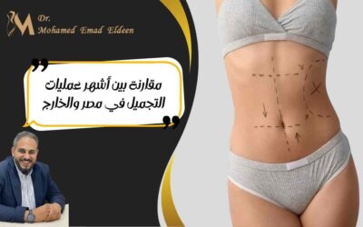 مقارنة بين أشهر عمليات التجميل في مصر والخارج
