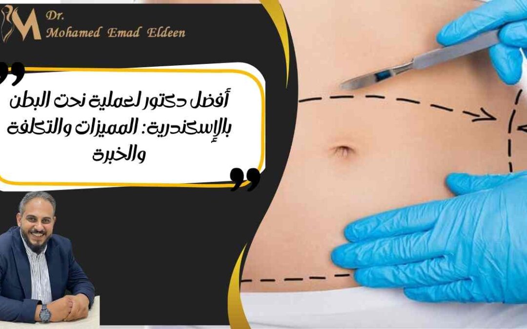 أفضل دكتور لعملية نحت البطن بالإسكندرية: المميزات والتكلفة والخبرة