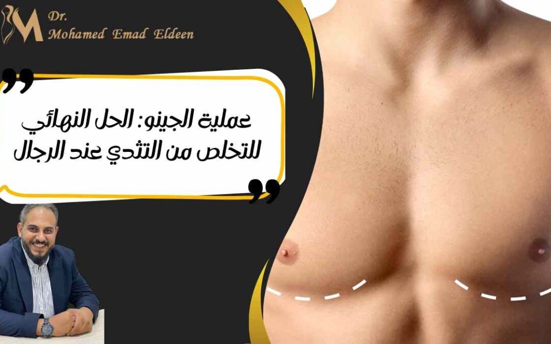عملية الجينو: الحل النهائي للتخلص من التثدي عند الرجال