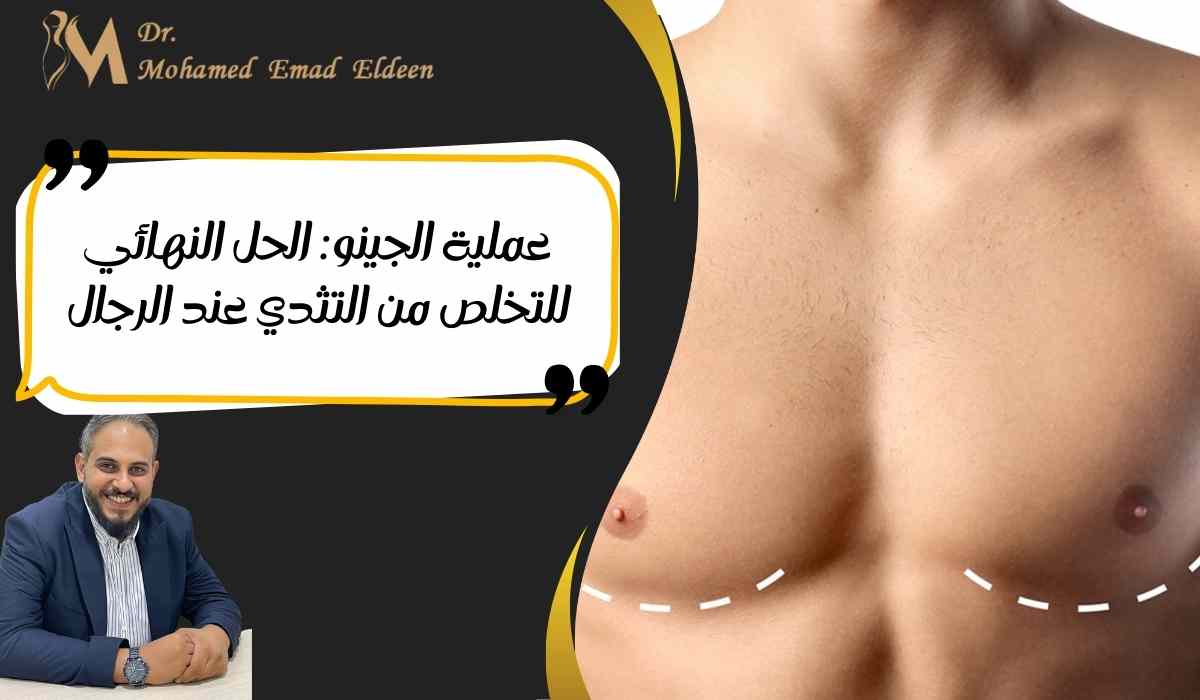 عملية-الجينو-للتخلص-من-التثدي