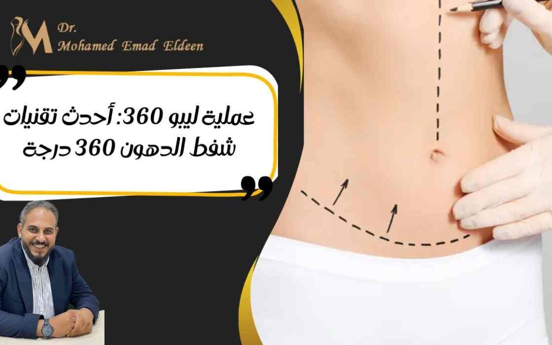 عملية ليبو 360: أحدث تقنيات شفط الدهون 360 درجة