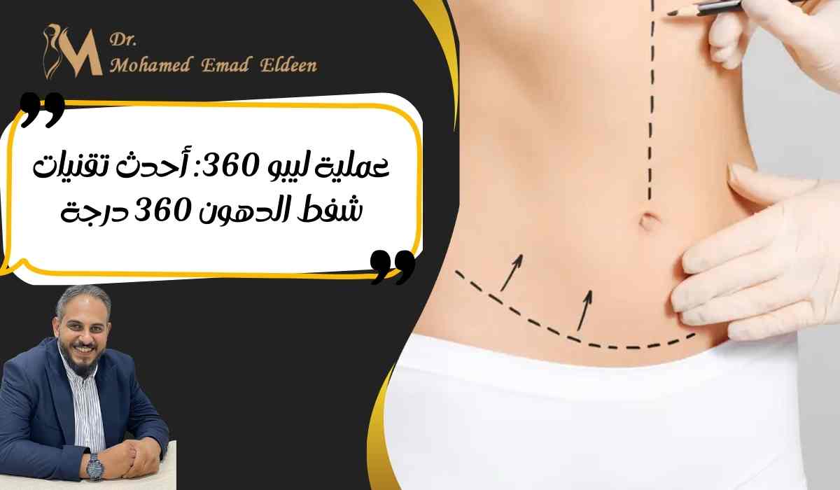 عملية-ليبو-360-أحدث-تقنيات-شفط-الدهون