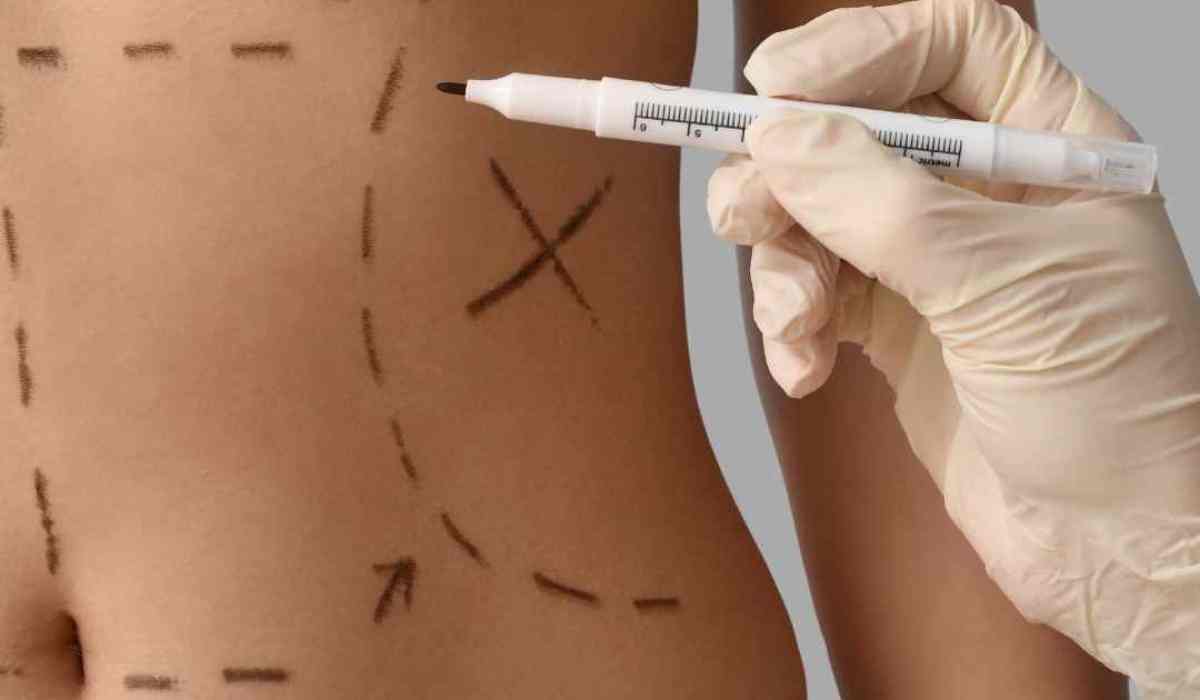 متى-تحتاج-فعليًا-إلى-دكتور-تجميل