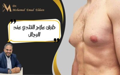 مقالات طرق علاج التثدي عند الرجال
