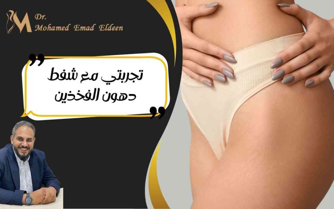 تجربتي مع شفط دهون الفخذين