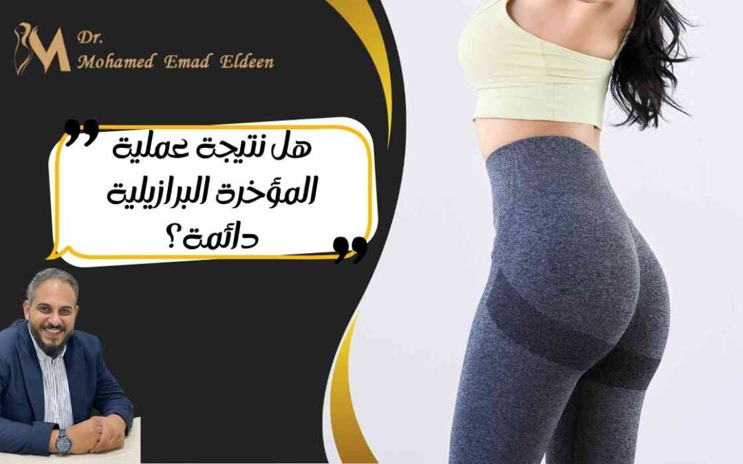 هل نتيجة عملية المؤخرة البرازيلية دائمة؟