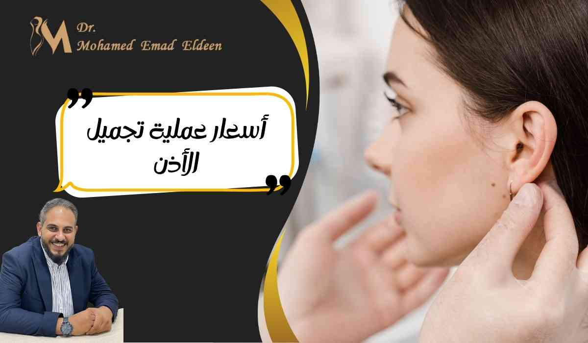 أسعار-عملية-تجميل-الأذن