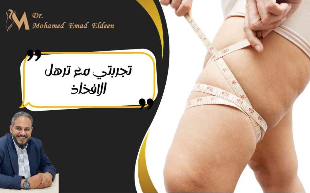 تجربتي مع ترهل الافخاذ