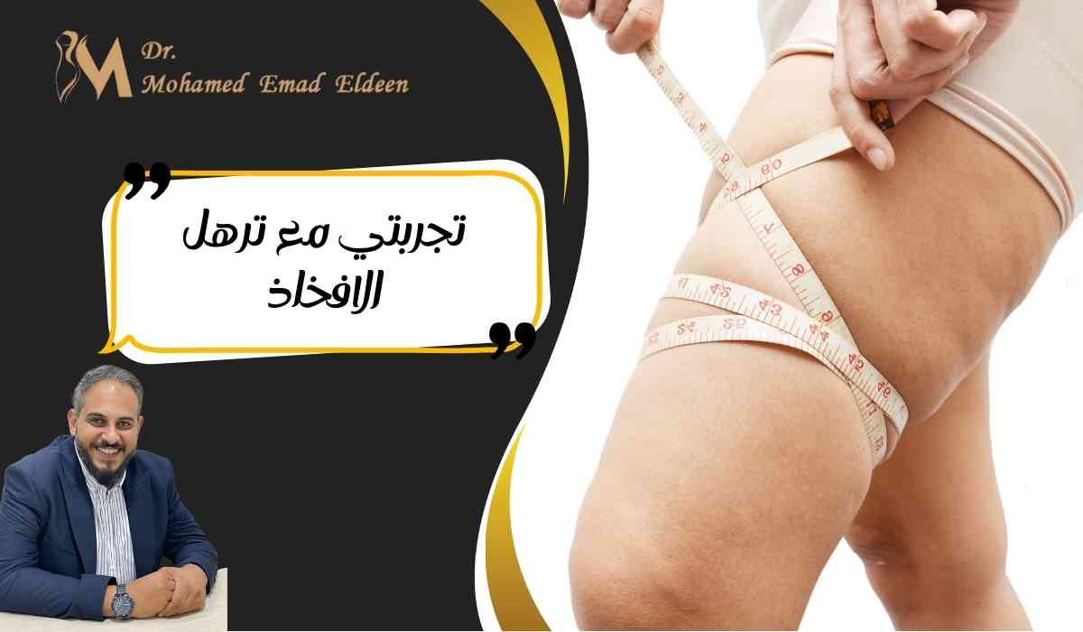 تجربتي-مع-ترهل-الافخاذ تجربتي-مع-ترهل-الافخاذ