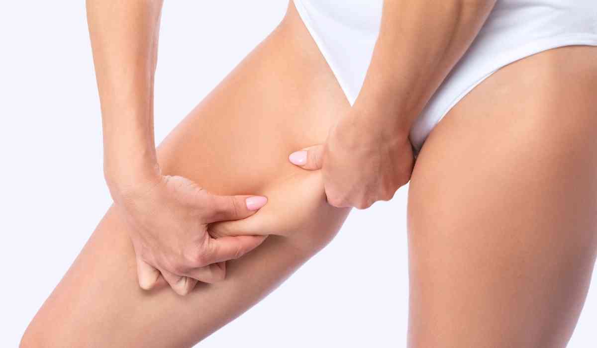 تجربتي-مع-ترهل-الافخاذ