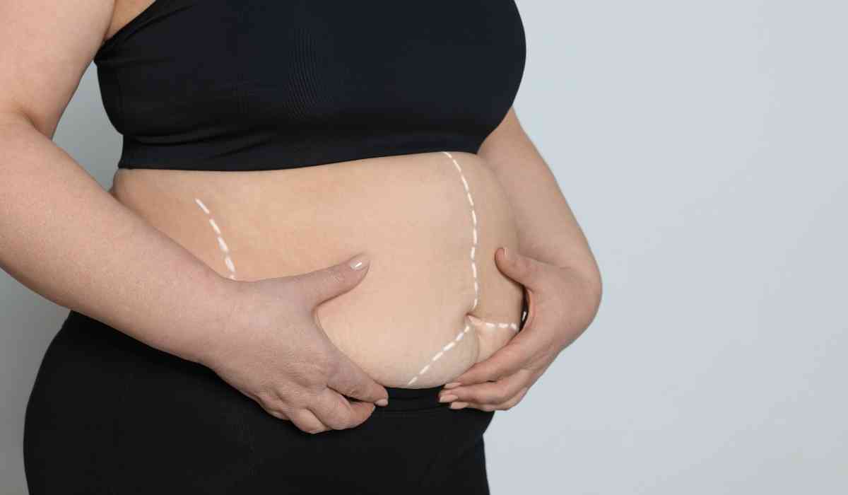 اسعار-عملية-شفط-الدهون-بالفيزر-في-مصر