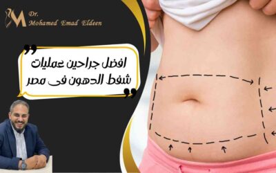 افضل جراحين عمليات شفط الدهون فى مصر