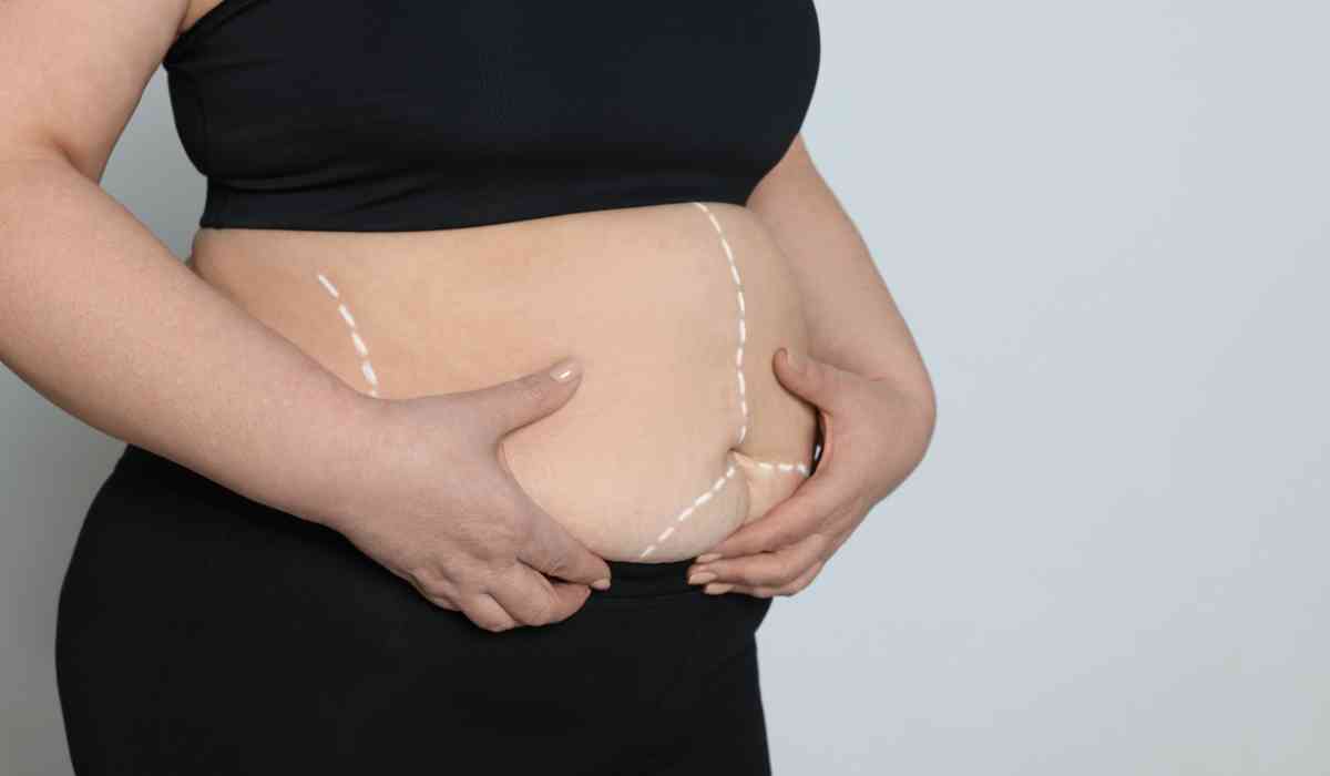 عمليات-شفط-الدهون-فى-مصر