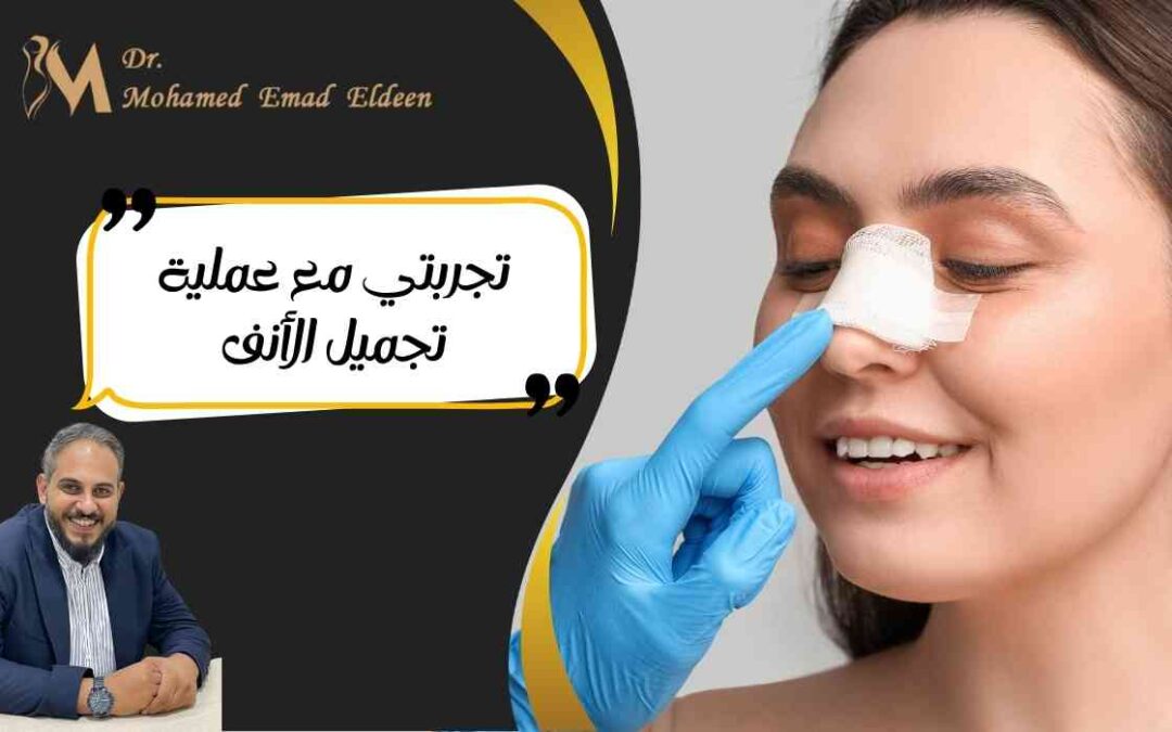 تجربتي مع عملية تجميل الأنف