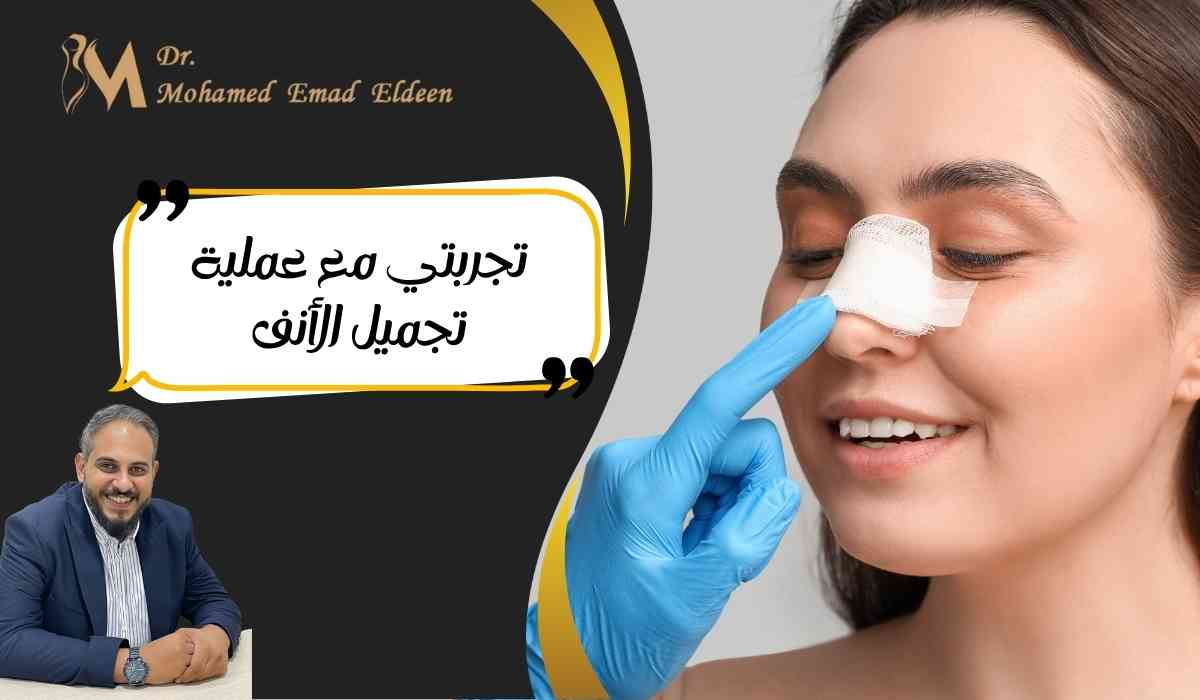 تجربتي-مع-عملية-تجميل-الأنف تجربتي-مع-عملية-تجميل-الأنف