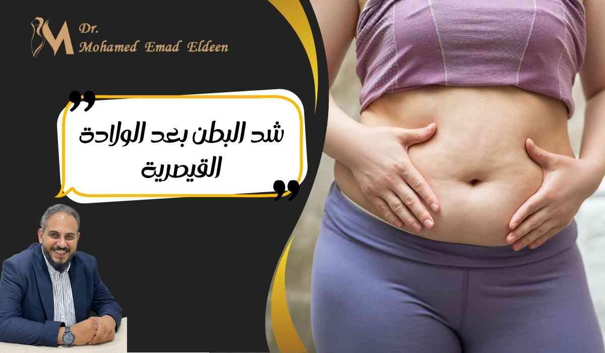 7 شد-البطن-بعد-الولادة-القيصرية