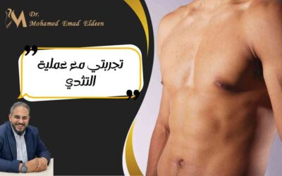تجربتي مع عملية التثدي