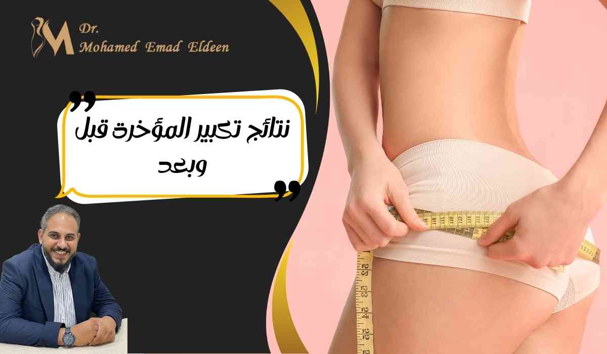 نتائج-تكبير-المؤخرة-قبل-وبعد