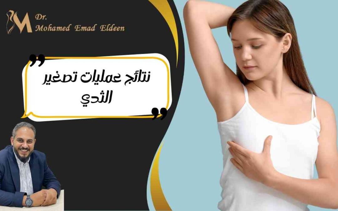 نتائج عمليات تصغير الثدي