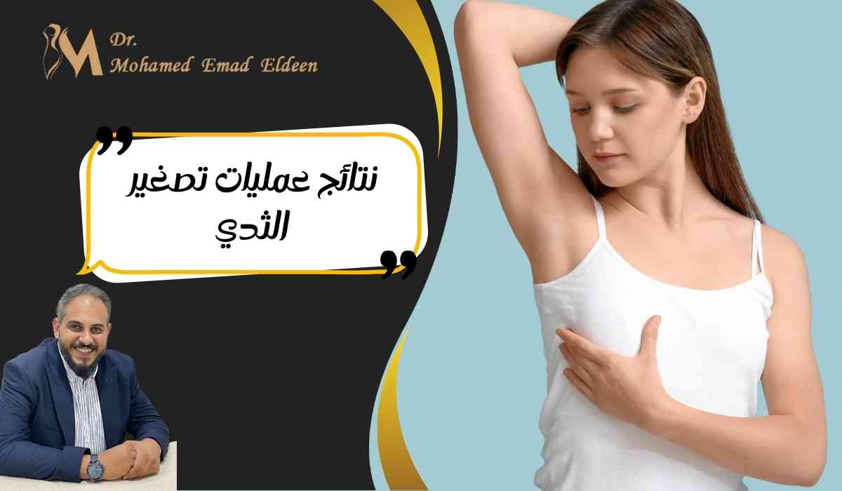 نتائج-عمليات-تصغير-الثدي