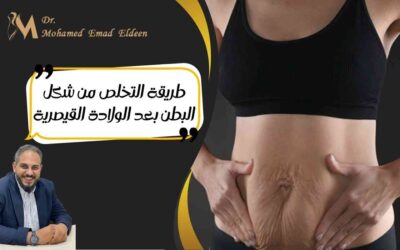طريقة التخلص من شكل البطن بعد الولادة القيصرية