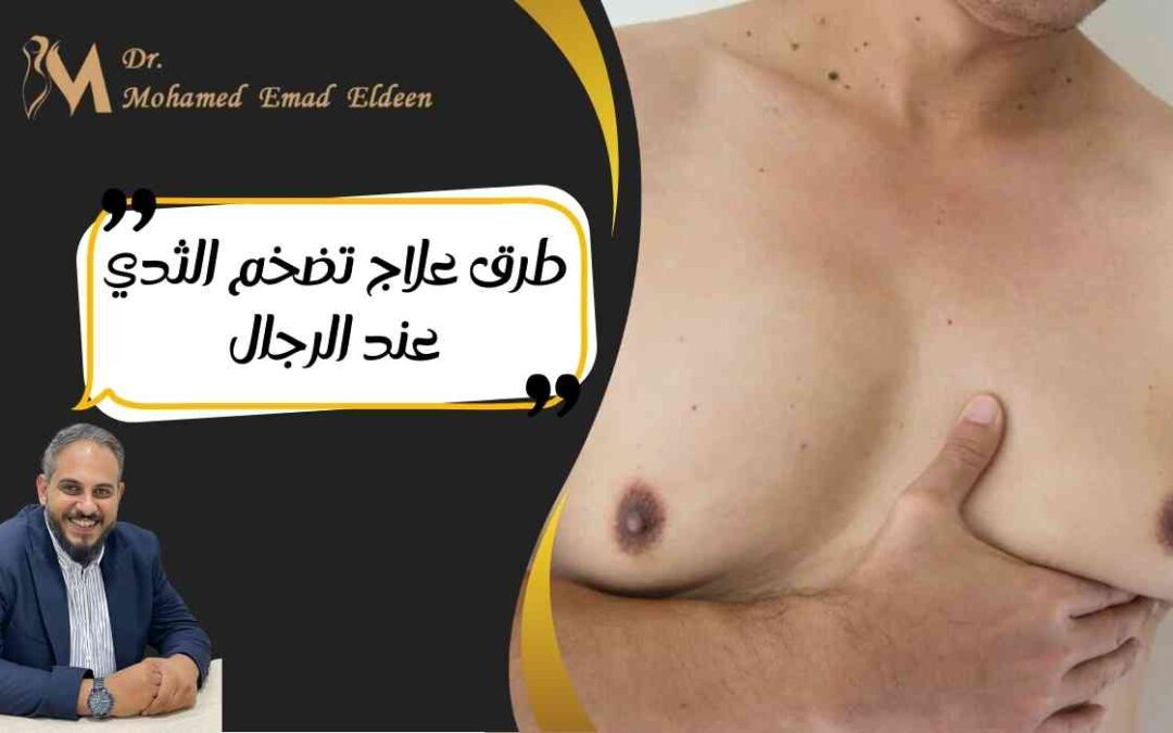 طرق علاج تضخم الثدي عند الرجال