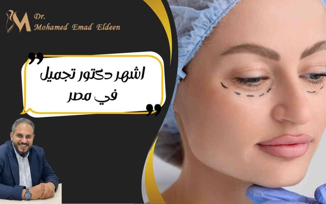 اشهر دكتور تجميل في مصر