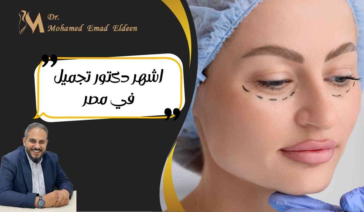 اشهر-دكتور-تجميل-في-مصر