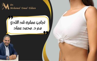تجارب عملية شد الثدي مع د. محمد عماد