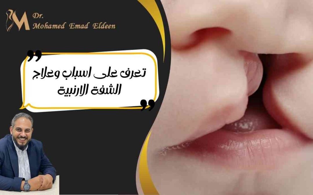 تعرف على اسباب وعلاج الشفة الارنبية