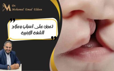 الصفحة الرئيسية تعرف على اسباب وعلاج الشفة الارنبية