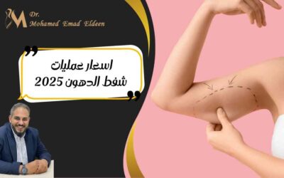 اسعار عمليات شفط الدهون 2026