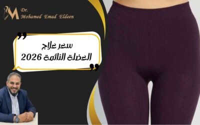 سعر علاج العضلة النائمة 2026