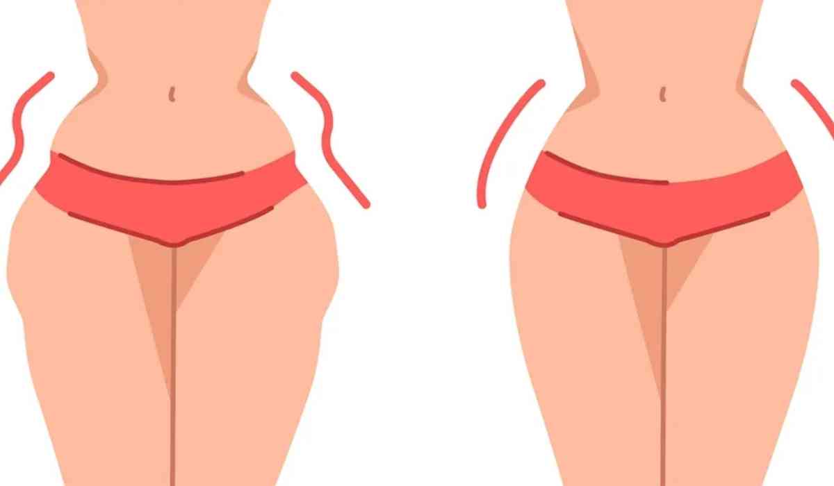 سعر-علاج-العضلة-النائمة-2026