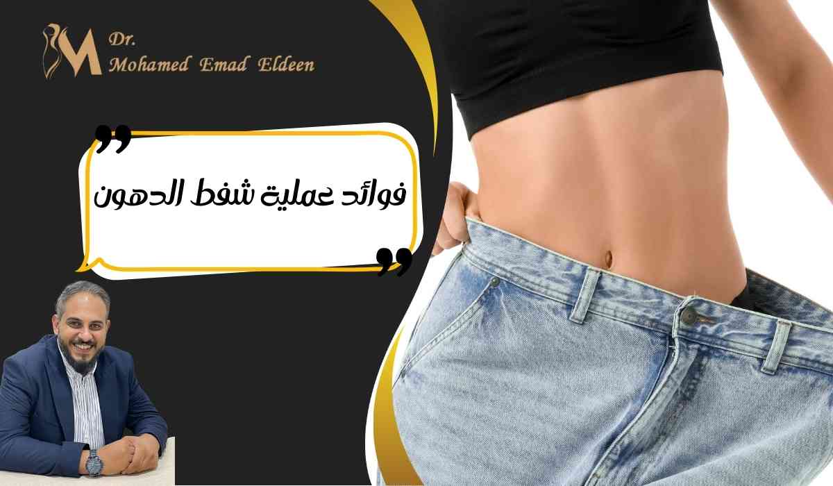فوائد-عملية-شفط-الدهون