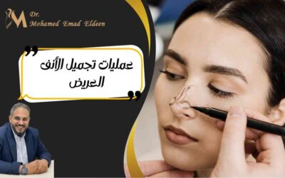 عمليات تجميل الأنف العريض