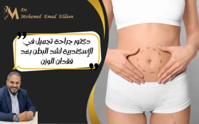 دكتور جراحة تجميل في الإسكندرية لشد البطن بعد فقدان الوزن