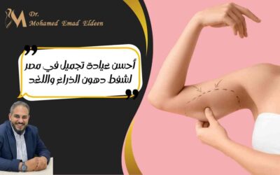 أحسن عيادة تجميل في مصر لشفط دهون الذراع واللغد