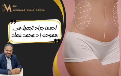 احسن جراح تجميل فى سموحه | د.محمد عماد