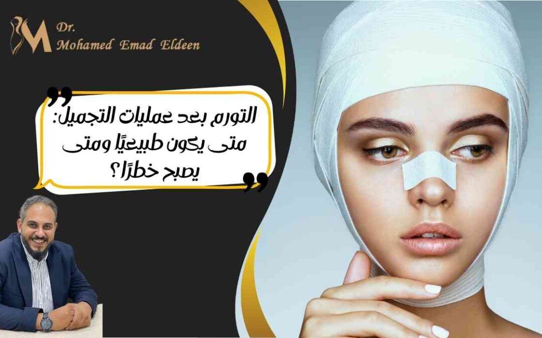 التورم بعد عمليات التجميل: متى يكون طبيعيًا ومتى يصبح خطرًا؟