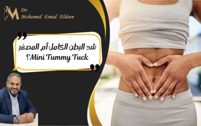 شد البطن الكامل أم المصغر Mini Tummy Tuck؟