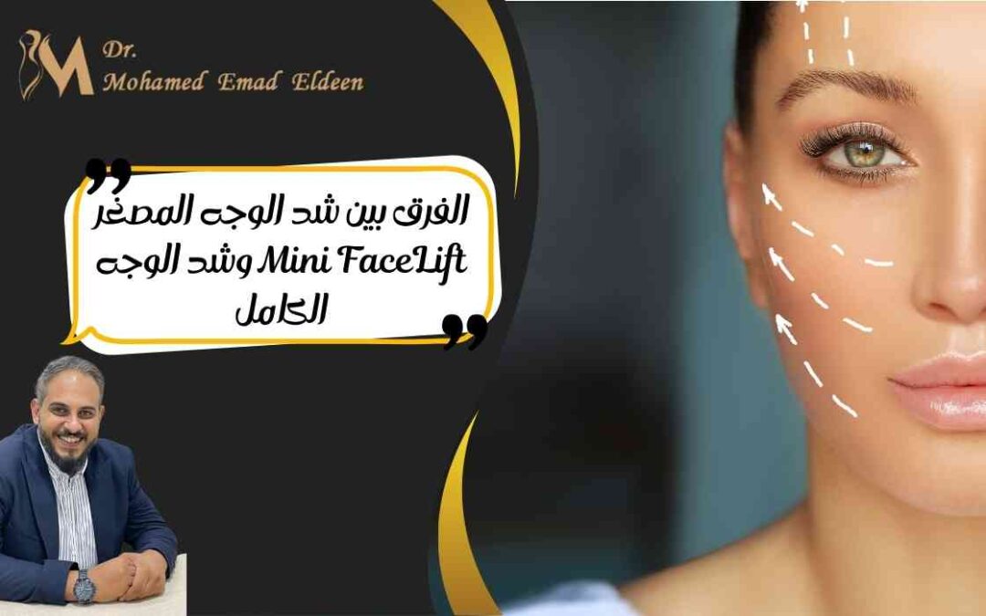 الفرق بين شد الوجه المصغر Mini FaceLift وشد الوجه الكامل