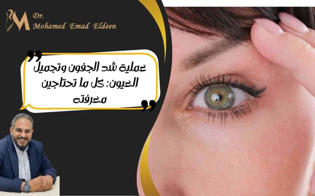 عملية شد الجفون وتجميل العيون: كل ما تحتاجين معرفته