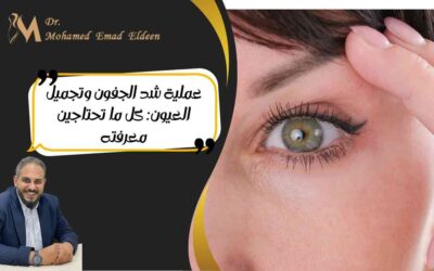 عملية شد الجفون وتجميل العيون: كل ما تحتاجين معرفته