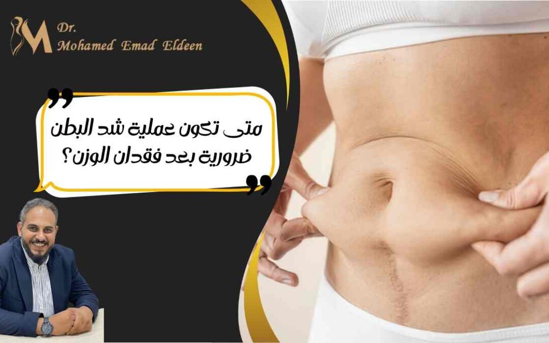 متى تكون عملية شد البطن ضرورية بعد فقدان الوزن؟