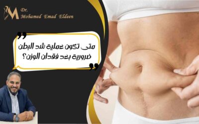 متى تكون عملية شد البطن ضرورية بعد فقدان الوزن؟