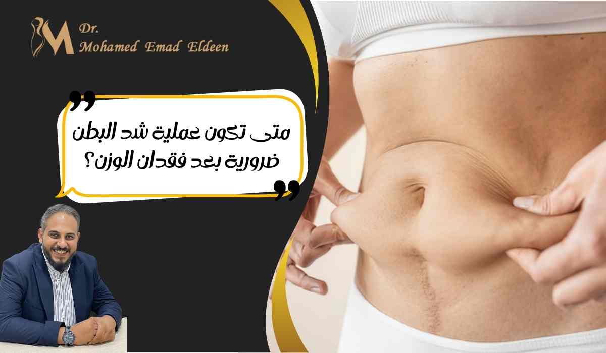 عملية-شد-البطن-بعد-فقدان-الوزن عملية-شد-البطن-بعد-فقدان-الوزن