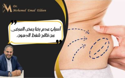 أسباب عدم رضا بعض المرضى عن نتائج شفط الدهون.