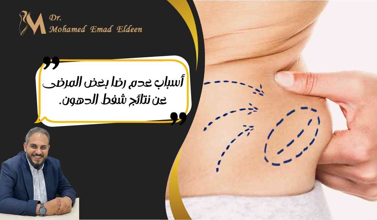 عدم-الرضا-عن-نتائج-شفط-الدهون (1) عدم-الرضا-عن-نتائج-شفط-الدهون